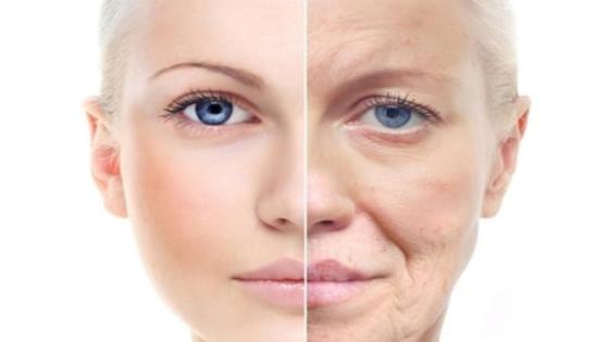 نقص الكولاجين