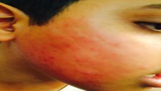 معلم يضرب طالبين ويجبرهما على شم القمامة في مكة!