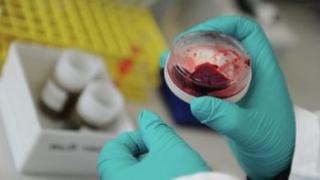 وزارة الصحة : تواصل الإنخفاض التدريجي لعدد المصابين بالكورونا خلال هذا الأسبوع