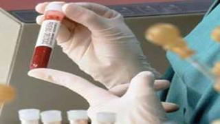 الان .. تحليل دم يكشف السرطان قبل الإصابه به