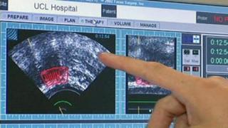 خطوة هامة في سبيل إيجاد دواء لسرطان البروستات