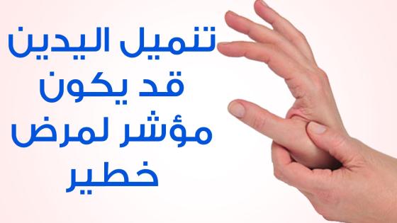 ما سبب تنميل اليدين