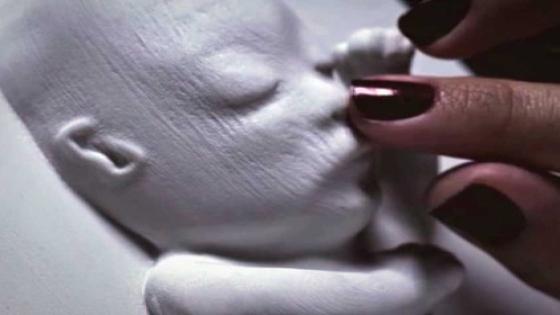 بالفيديو: طابعة ثلاثية الأبعاد للمس الجنين قبل ولادته !