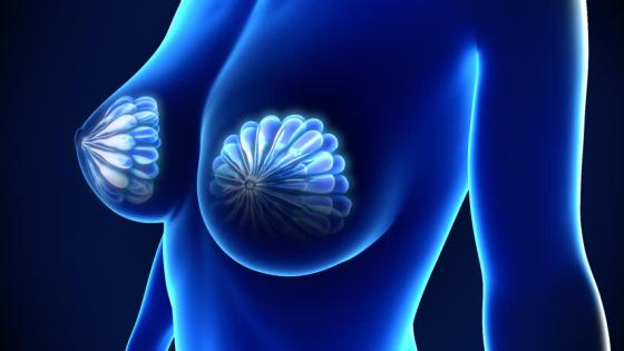 علاج سرطان الغدة الثديية